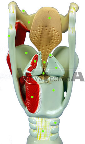 Large Larynx - Posterior View